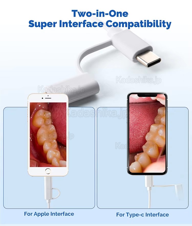 歯科用デジタル口腔内カメラ Type-C / Micro USB 2in1、2.0MPピクセル